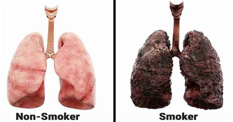 Why Smoking Every Day Is Harmful For Your Lungs