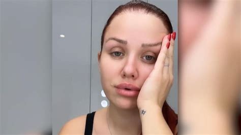 Wirklich Schrecklich Kim Gloss Bereut Beauty Eingriff Video Vip De