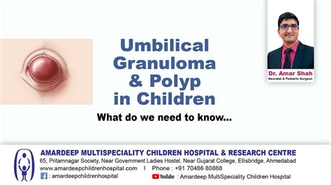 Umbilical Granuloma And Polyp English Youtube