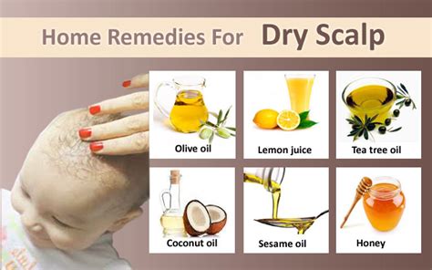 Effective And Easy Natural Remedies For Dry Scalp Arbkan