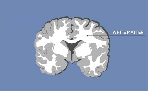 Grey Matter Vs White Matter In The Brain