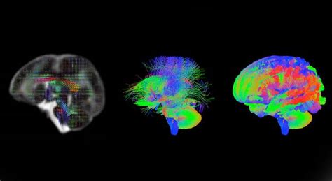 Baby Brain Scans Reveal Trillions Of Neural Connections Bbc News