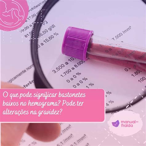 Bastonetes 0 O Que Pode Ser