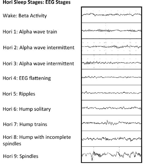 Hori Sleep Stages Representative Examples Of Eeg Data 5 Sec Epoch Of