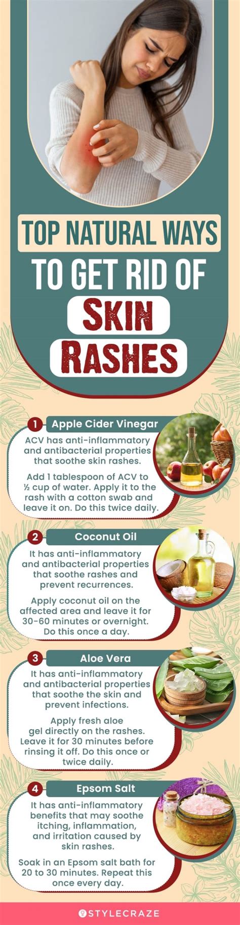 21 Home Remedies To Get Rid Of Rashes On The Face Diet And Prevention