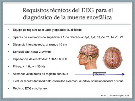 Muerte encefalica concepto muerte la pérdida total e irreversible de las funciones del encéfalo, ocasionado por un daño conocido, que determina el cese permanente del organismo como. Diagnóstico de la muerte encefálica