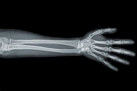 Snooping On The X Ray Tech A Patients Dilemma — Propublica