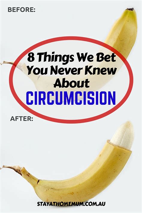 8 Shocking Facts About Circumcision In Our Society Stay At Home Mum