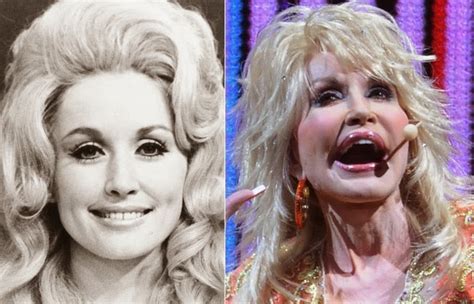 Dolly Parton Plastic Surgery Before And After Top Piercings