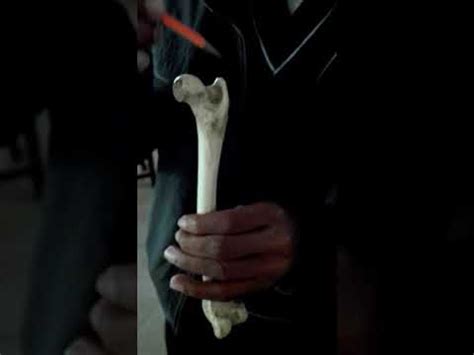 Anatomy of the femur bone of dog ,veterinary anatomy dvm - YouTube