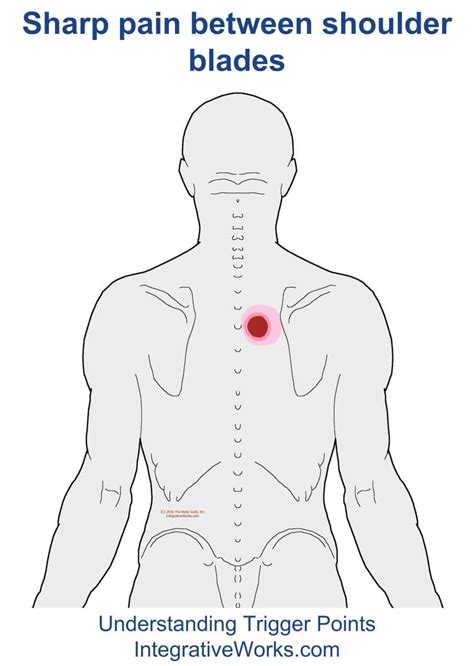 Famous Instant Relief For Pinched Nerve In Shoulder Ideas