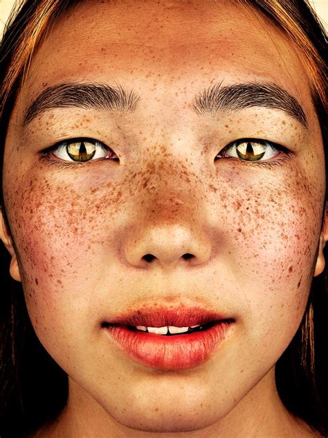 Stunning Beauty Of Freckled Individuals Fubiz Media Beautiful