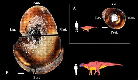 Jump to navigation jump to search. Bone cross-sections showing the general histological ...