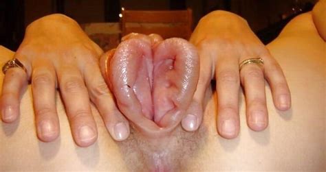 Most Extreme Abnormal Giant Clit 89 Pics 2 Xhamster