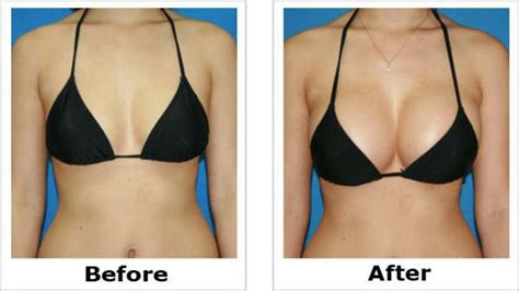The usage of fenugreek for breast enlargement has been proved its effectiveness as follows; BREAST ACTIVES - Advanced All Natural Breast Enhancement ...