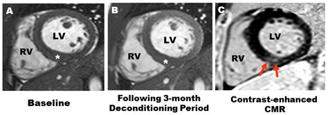 Cardiovascular Magnetic Resonance Imaging In The Assessment Of Athletes