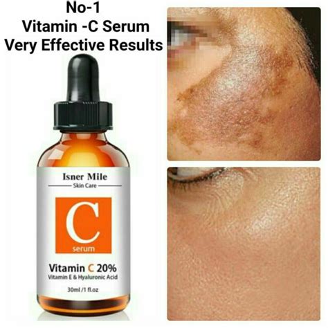 E) in a spoon of coconut oil and apply on the. 30ml Vitamin C 20 Serum Hyaluronic Acid Kojic Skin Glowing ...