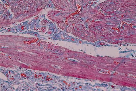 Anatomi Pendidikan Dan Sampel Histologis Jaringan Epitel Kolom