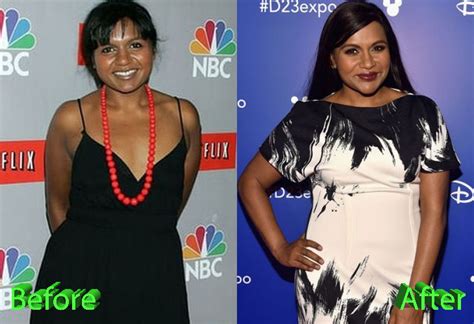 However, her appearance isn't something that's standard for a star. Mindy Kaling Plastic Surgery: Is it a Project Well Done?