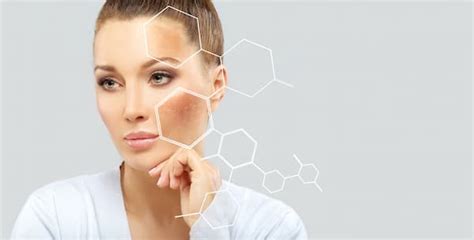 Melasma Treatments By Dr V Medical Aesthetics Get Fairer Skin