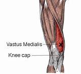 Vastus Lateralis Muscle Exercises Pictures