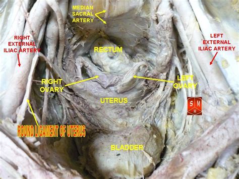 Its upper outer border form a ligament where ovarian vessels pass. File:Round ligaments of uterus.jpg - Wikimedia Commons