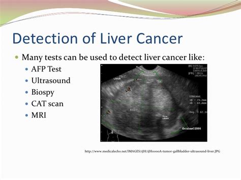 However, many of the symptoms listed can occur during the first year of life for many other reasons besides cancer. Liver Cancer
