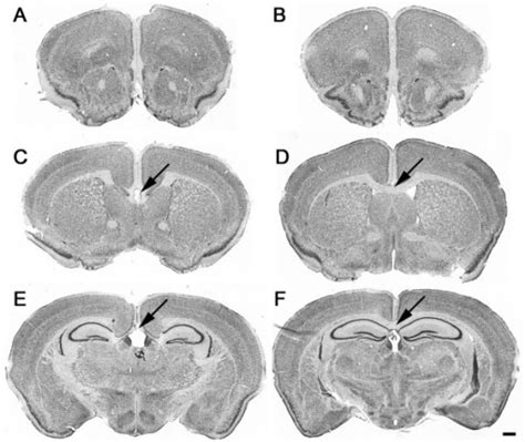 Figure 1 Histopathologic Characterization Of The BTBR Mouse Model Of