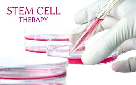 stem cell therapy shows potential in treating medication resistant epilepsy patients epilepsyu