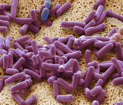 İnsan, tavuk, sığır, koyun, manda, domuz, ve diğer hayvanlarda pasteurellosis. Pasteurella Multocida Bacteria Photograph by Steve ...
