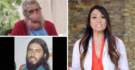 Dr Pimple Popper Sandra Lee Tries Not To Be Intimidated By Rogers Rhinophyma Case Meaww