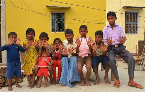 Mereka juga akan terjebak pada pola yang sama seperti pola yang kita jalankan. VIRAL! Turun-temurun, 2 Keluarga Besar Ini Punya 12 Jari ...