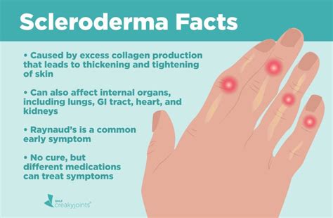 What Is Scleroderma Understanding Symptoms Causes And Treatments