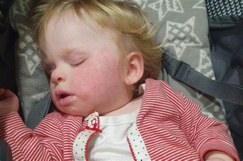 Mum Of Baby With Scarlet Fever Goes On Frantic Late Night Search For