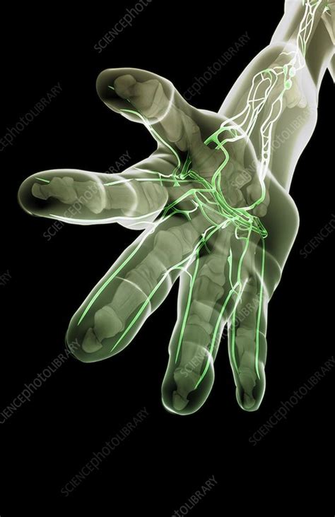 The Lymph Vessels Of The Hand Stock Image C0081546 Science Photo