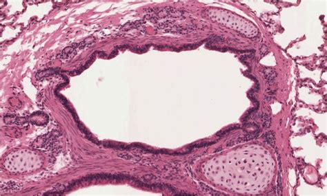 Lung Trachea Divides Into 2 Primary Bronchi Extrapulmonary Bronchi