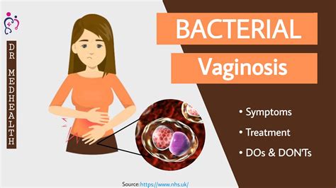 Bacterial Vaginosis Symptoms Bacterial Vaginosis Treatment Youtube