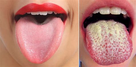 10 Secrets You Didnt Know Lie Inside Your Mouth Therichest