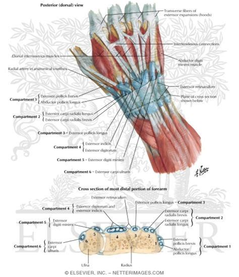 Tendonitis is the swelling of a tendon, which is a thick cord attaching a muscle to a bone. Extensor Indicis Proprius Extensor Tendons at Wrist