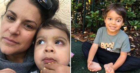 Madre Comparte Fotos De Su Hijo Que Perdió Un Ojo Por Cáncer Para Que