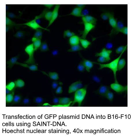 Plasmids are small circular dna molecules that naturally occur in bacteria, and are actually used by the bacteria to transfer genetic information. SAINT-DNA • Synvolux Products