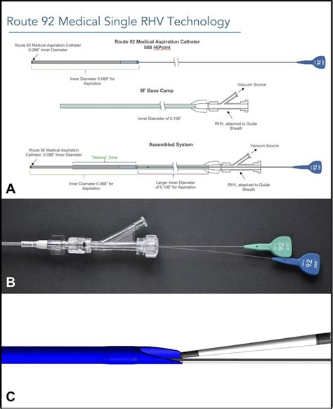 Aspiration Thrombectomy Using A Novel 088 Catheter And Specialized