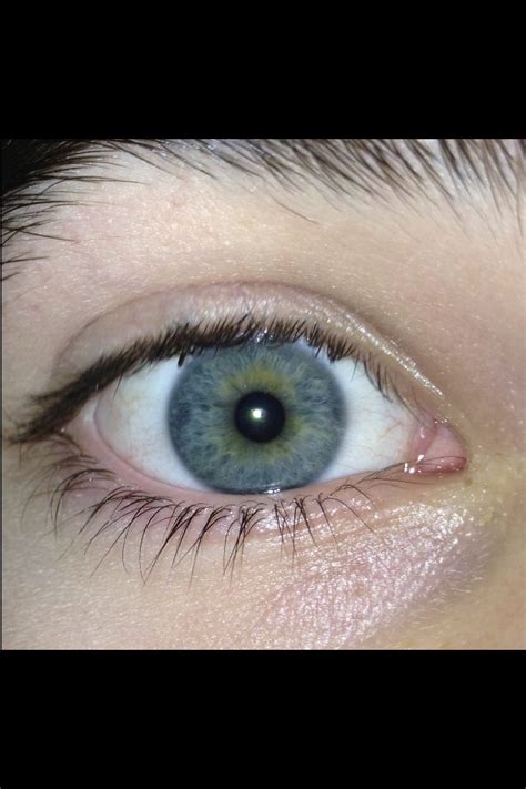 Best Central Heterochromia Images On Pholder Eyes