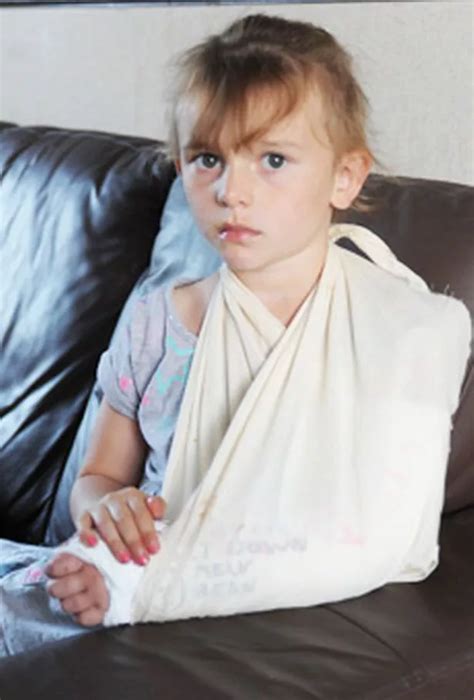 Girl With Broken Arm Denied Ambulance Gazette Live