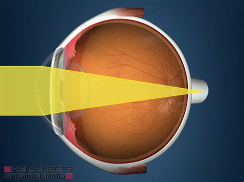 Vision impairment - Myopia, Hyperopia, Presbyopia | Know the Eye