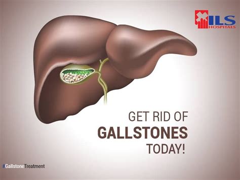 Gallbladder‬ Stones Are Always Very Painful Lets Sit Together And
