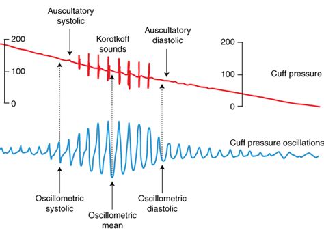 Cuff Pressure Korotkoff Sounds And Observed Oscillations Download