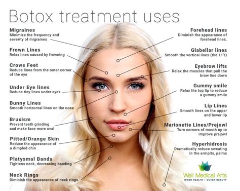 Whats Botox Treatment Negative Effects Of Botox Treatment Injections