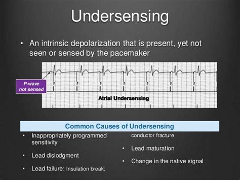 Essentials Of Ecg Interpretation Aphrs