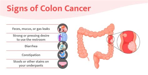 Is Bowelpoop Leakage A Sign Of Cancer Oasis Clinic